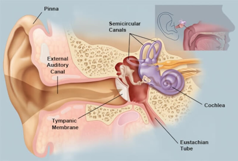 Microsuction