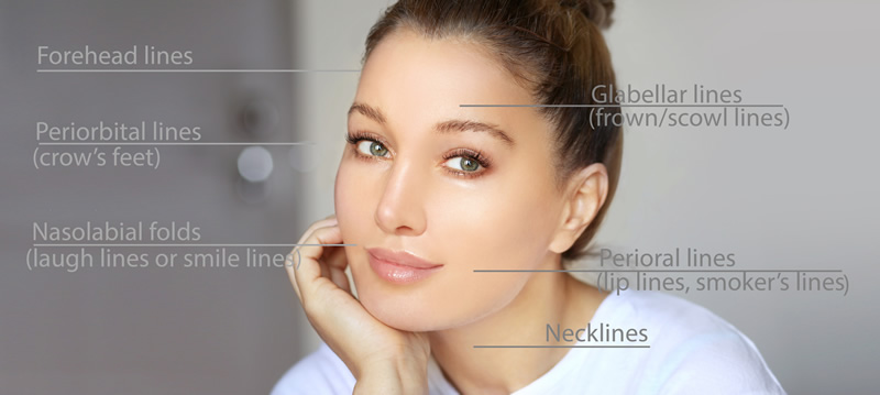 Dermal lip fillers