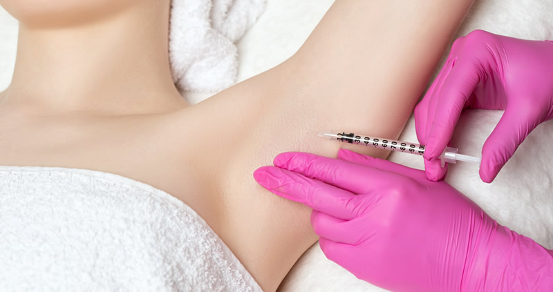 Excessive Underarm Sweating